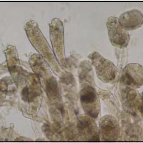 thumbnail for publication: Common Freshwater Fish Parasites Pictorial Guide: Sessile Ciliates